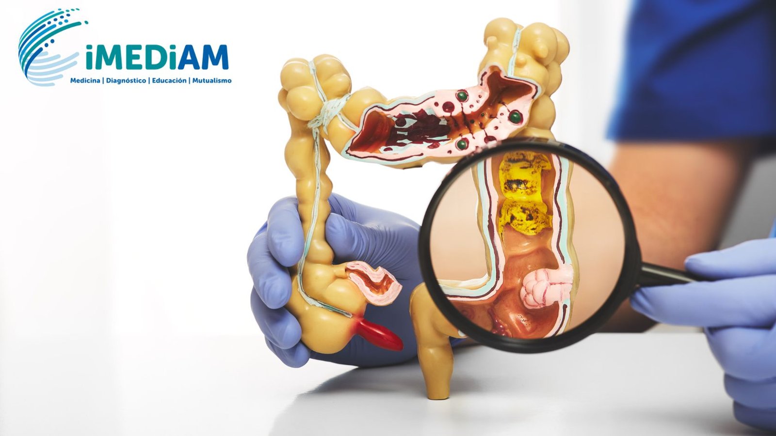 Dolor abdominal agudo: el rol clave de la tomografía multicorte para un diagnóstico a tiempo