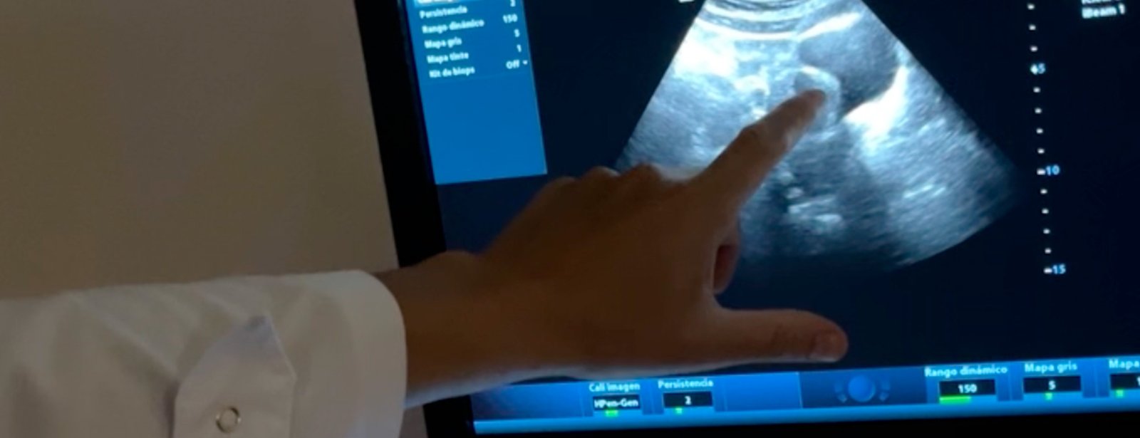 Ecografía ginecológica: diferencias entre el estudio pelviano y el transvaginal