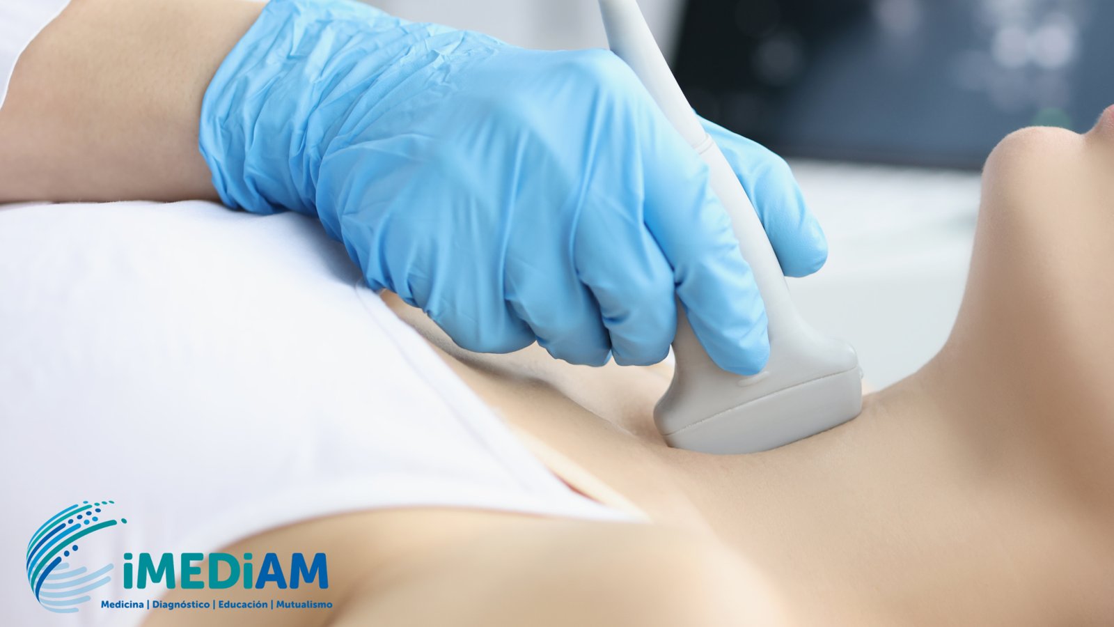 Ecografía Doppler de vasos de cuello: una aliada clave para prevenir el ACV