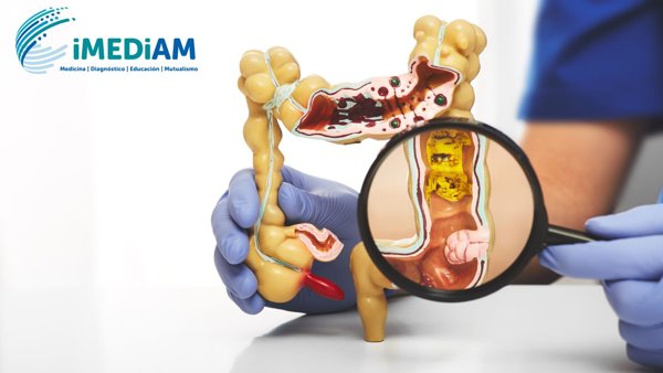 Dolor abdominal agudo: el rol clave de la tomografía multicorte para un diagnóstico a tiempo