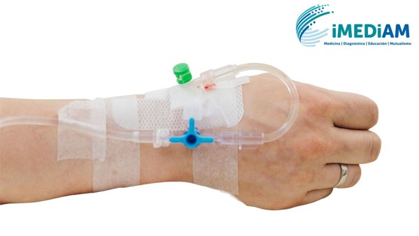 Contraste endovenoso en tomografía: preparación, qué se siente y mitos comunes